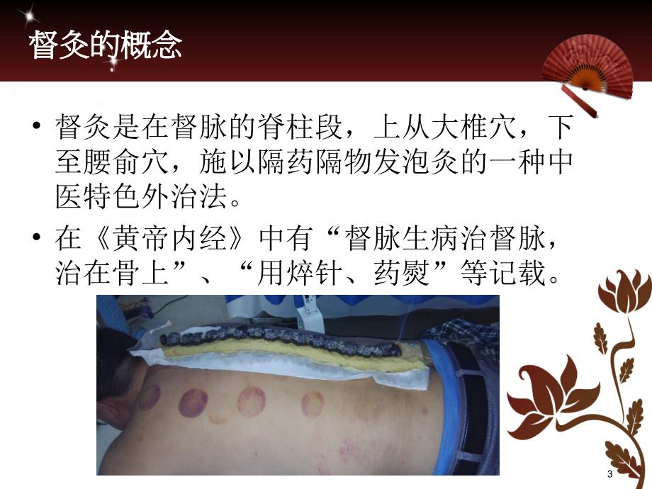 中医适宜技术推广督灸ppt课件.pptx_第3页