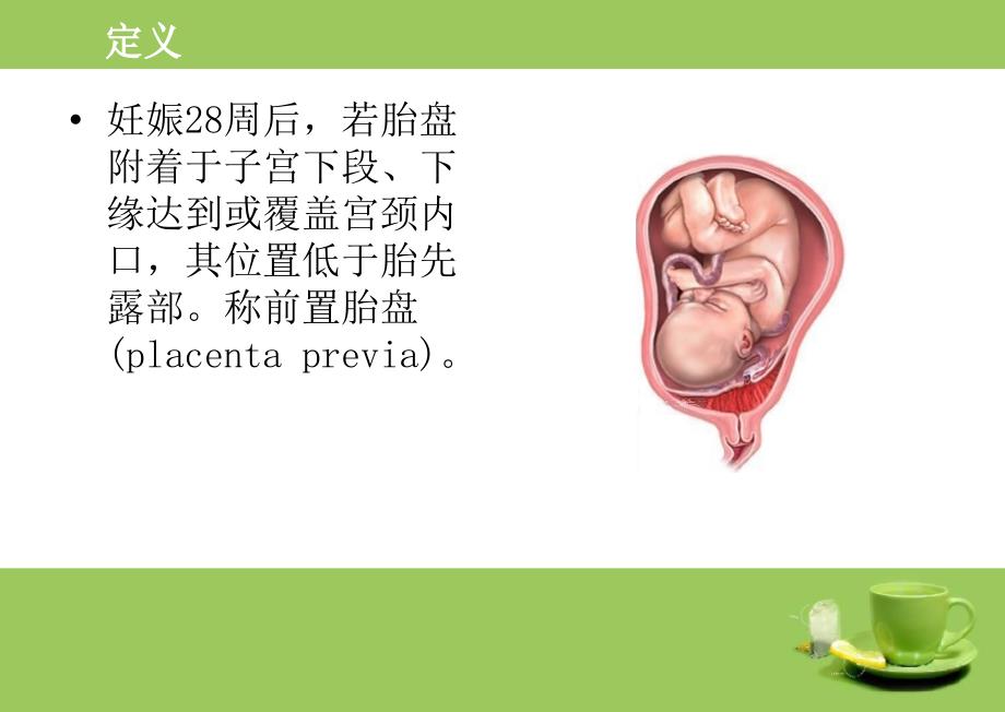 前置胎盘PPT课件.ppt_第3页