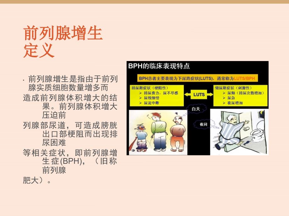 前列腺增生的围手术期护理定稿.ppt_第2页