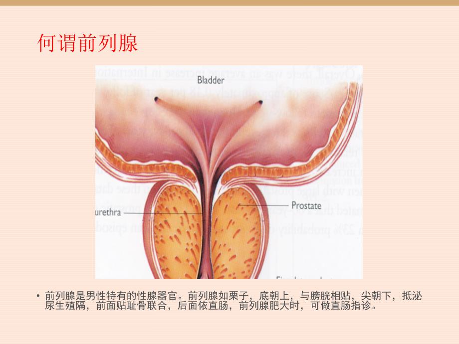 前列腺增生的围手术期护理定稿.ppt_第3页