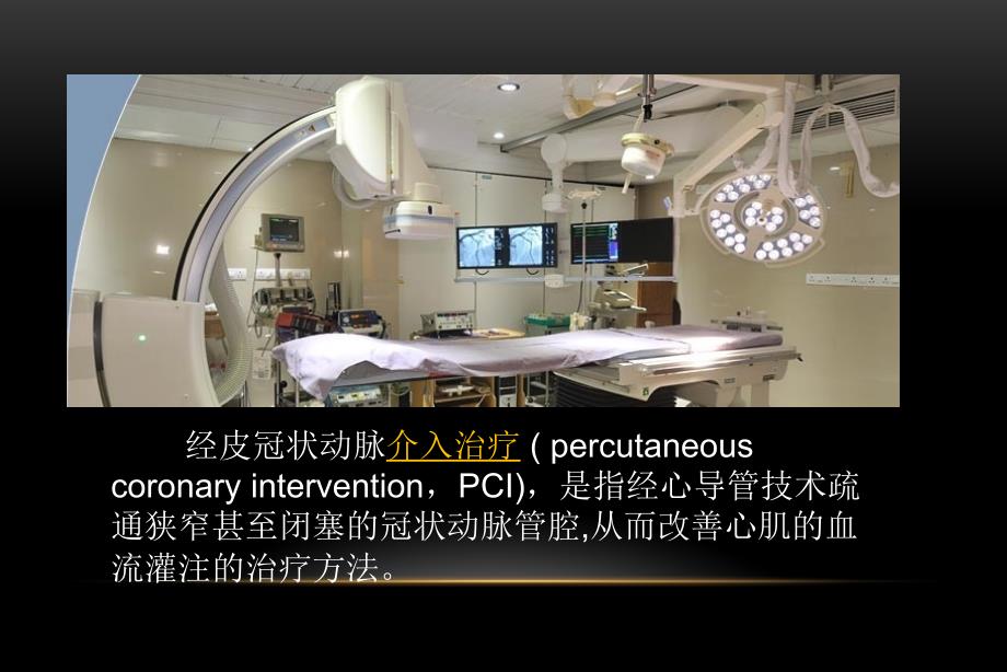 冠脉介入发展史.ppt_第2页