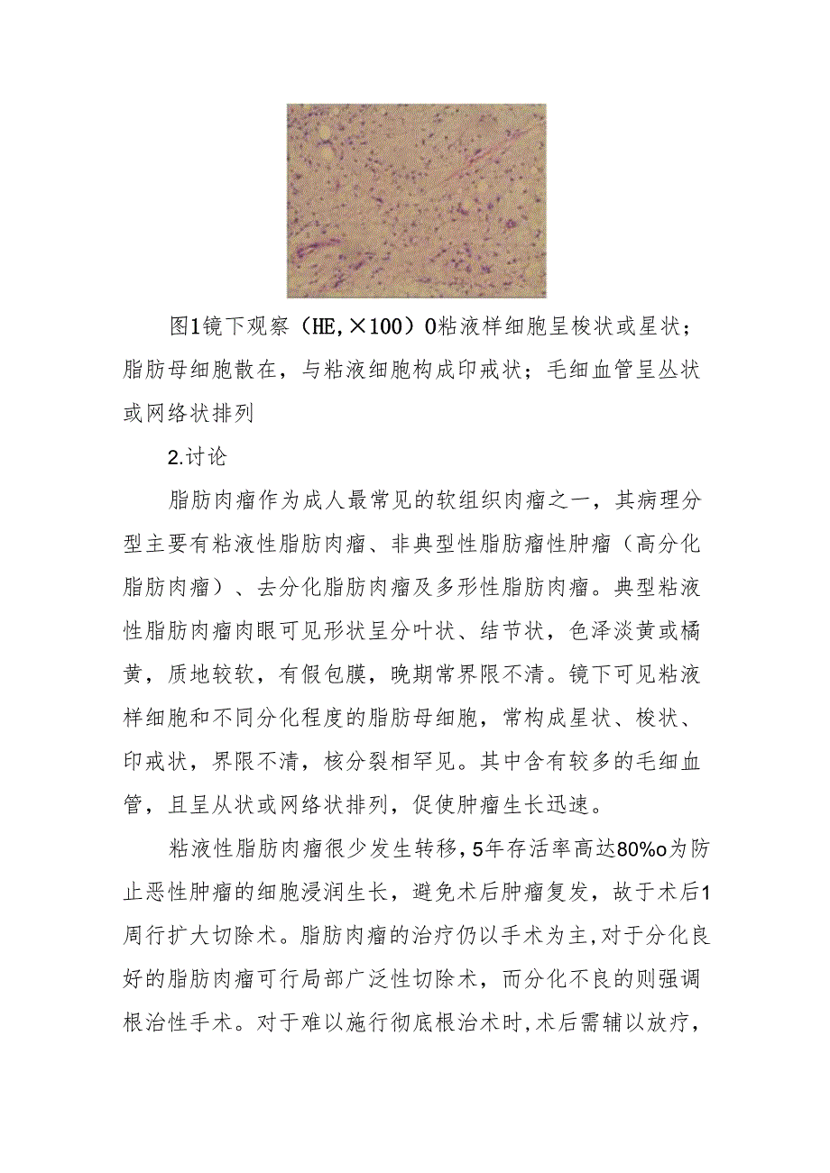 医师晋升副主任医师高职称病例分析专题报告（舌部粘液性脂肪肉瘤病）.docx_第2页