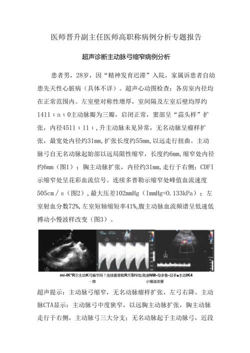 医师晋升副主任医师高职称病例分析专题报告（超声诊断主动脉弓缩窄）.docx