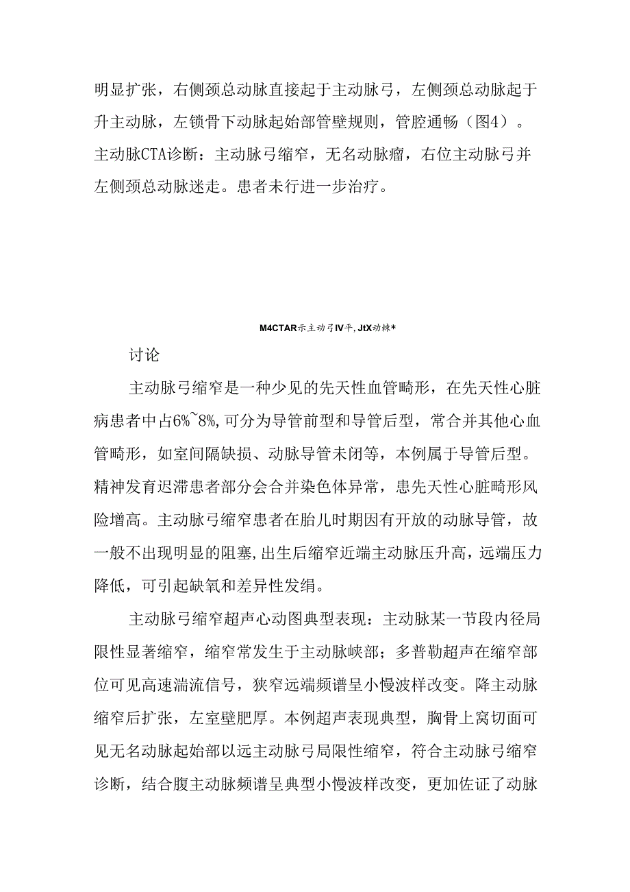 医师晋升副主任医师高职称病例分析专题报告（超声诊断主动脉弓缩窄）.docx_第2页