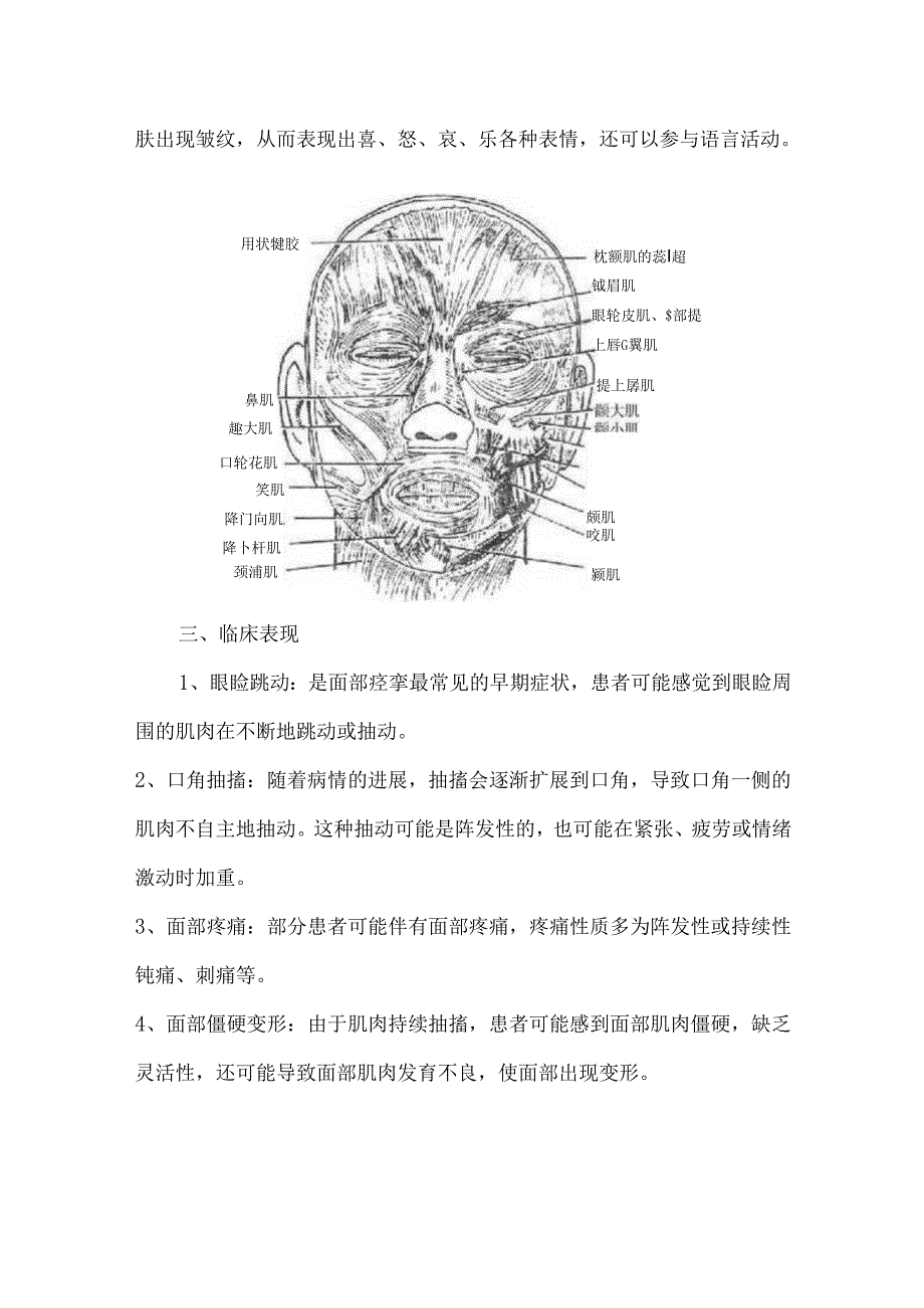 面肌痉挛的康复治疗.docx_第2页