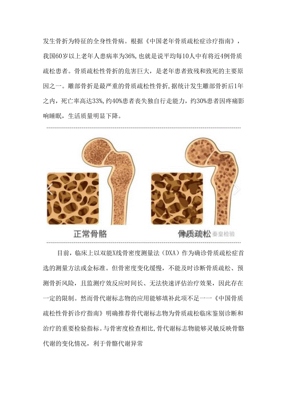 骨代谢标志物的临床应用与结果解读.docx_第2页