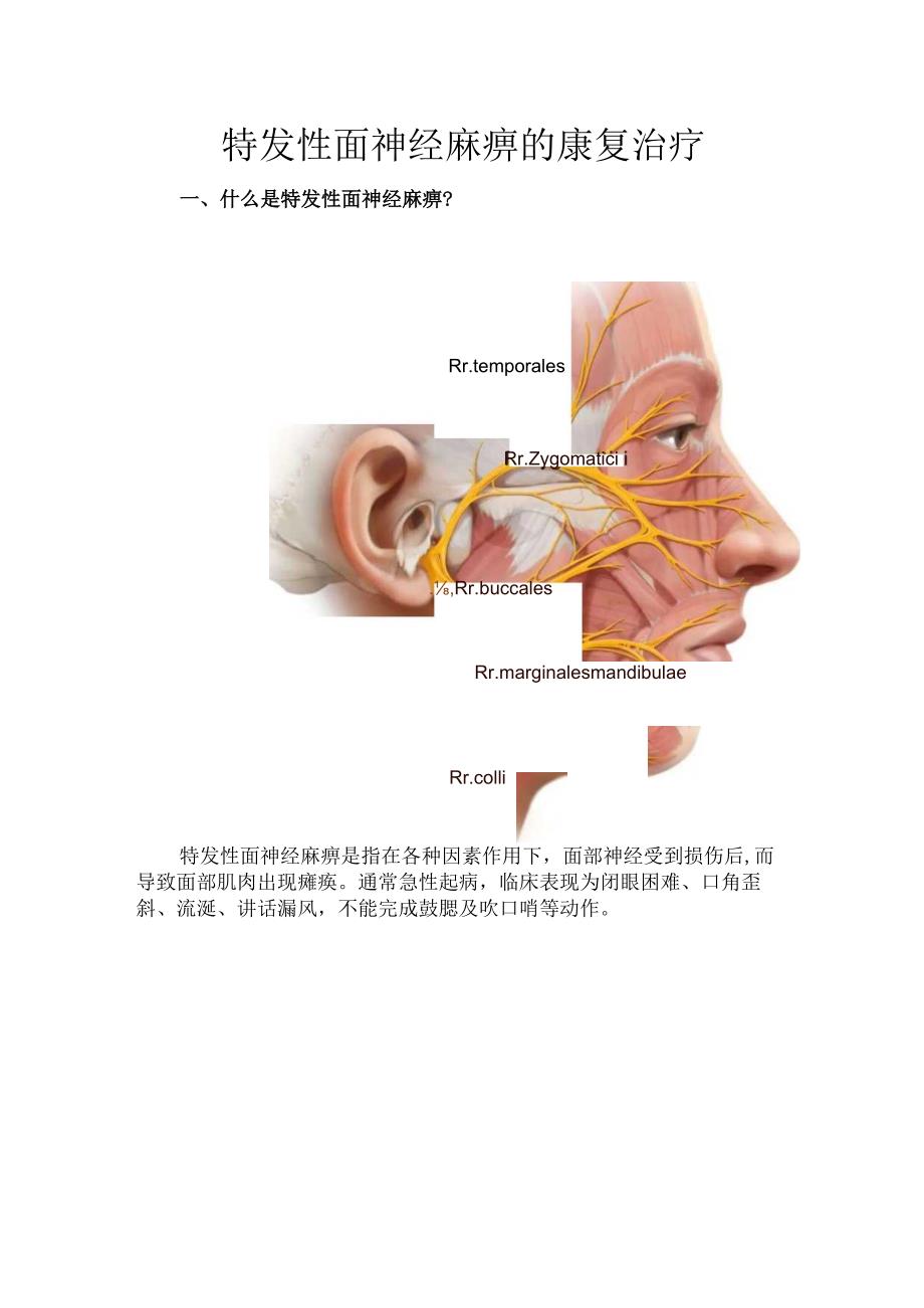特发性面神经麻痹的康复治疗.docx_第1页