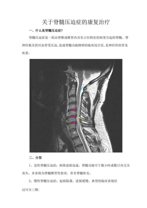关于脊髓压迫症的康复治疗.docx