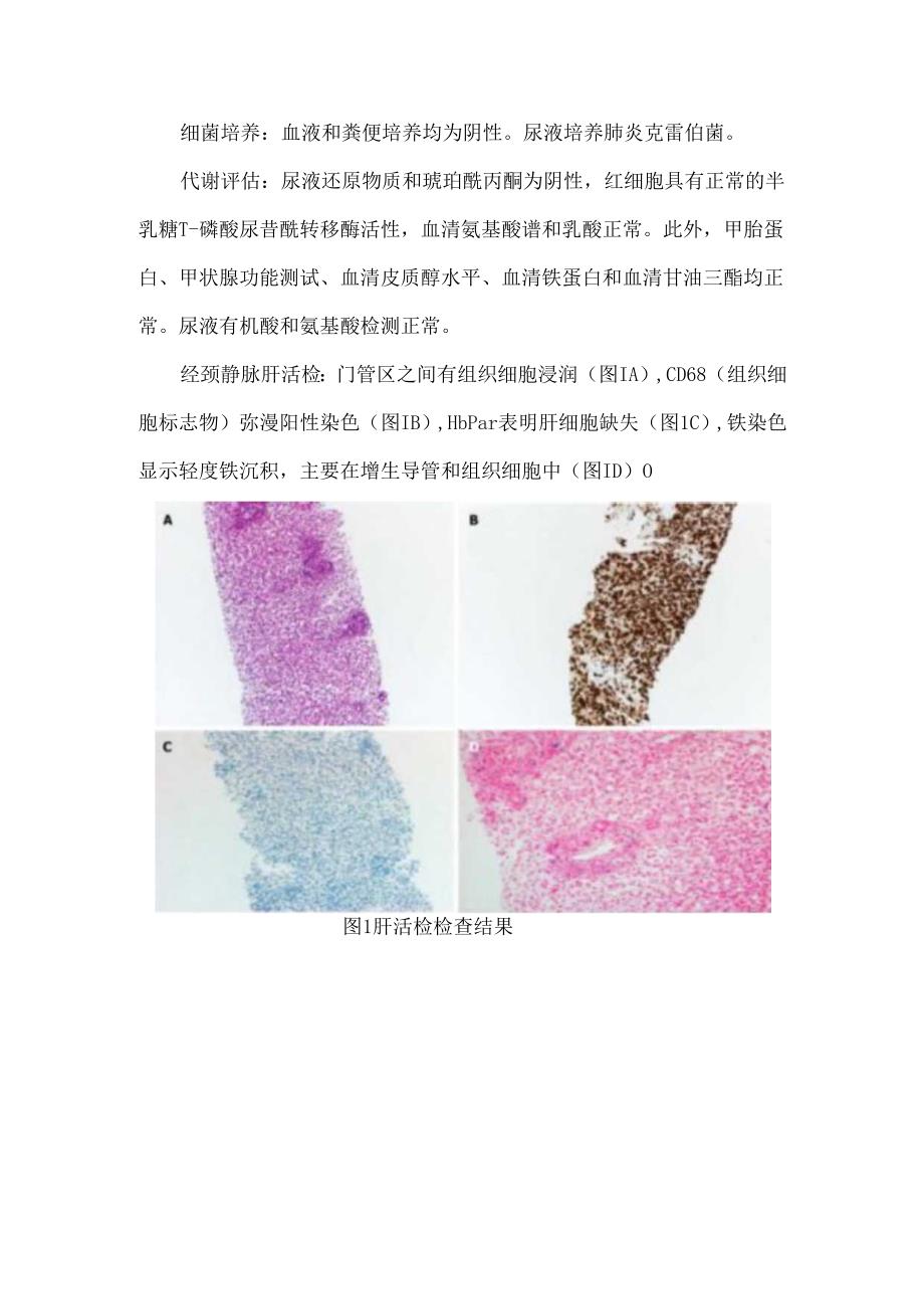新生儿肝衰竭的独特表现.docx_第2页