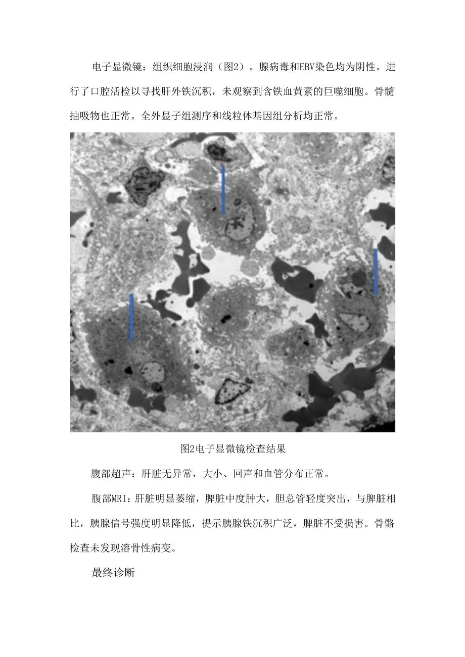新生儿肝衰竭的独特表现.docx_第3页